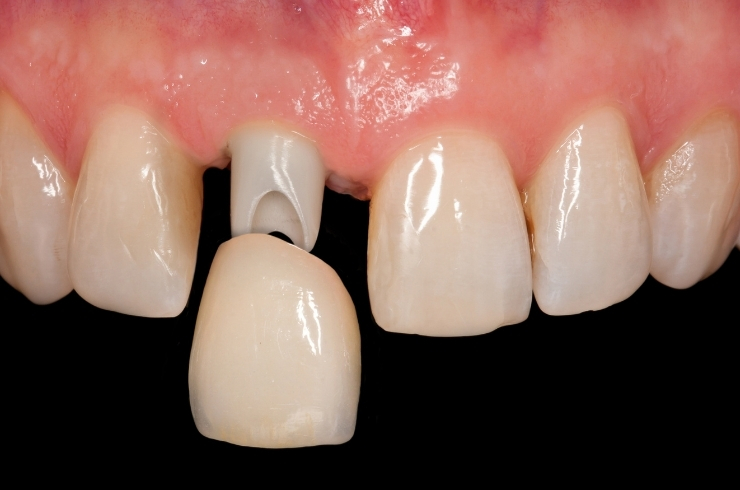 SORA DENTAL