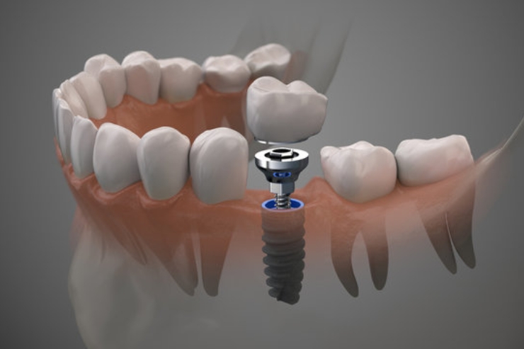 SORA DENTAL