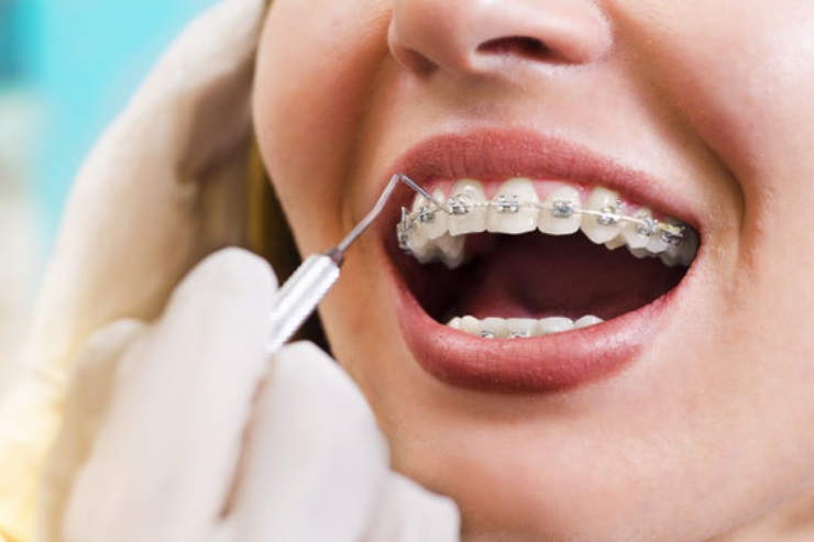 SORA DENTAL