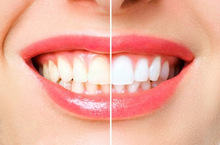 SORA DENTAL