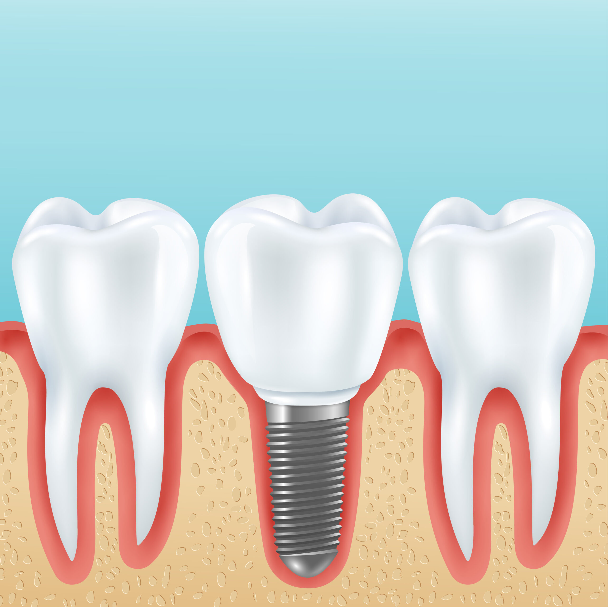 SORA DENTAL